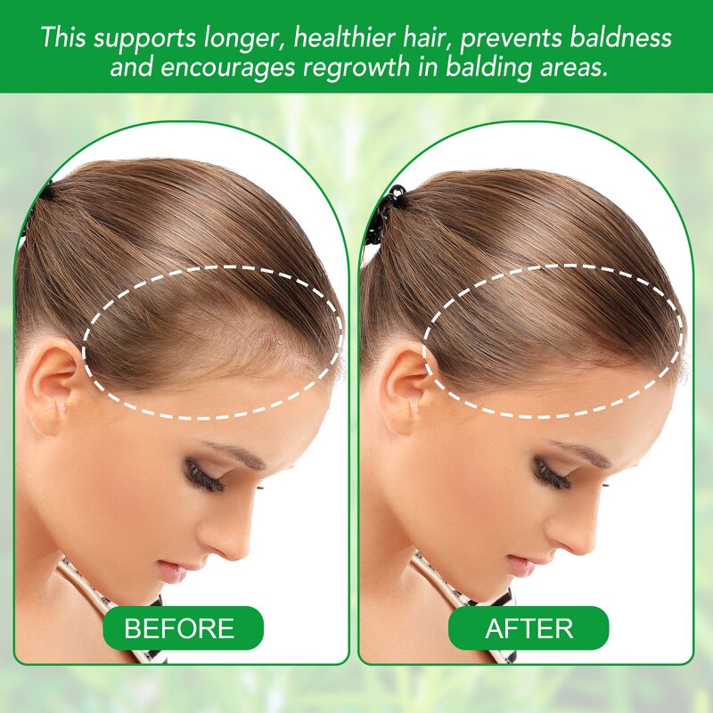 Batana Oil - YECUCE Honduras 100% Raw Cold Pressed Organic Hair Growth