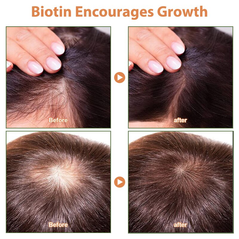 Batana Oil - Uocasi 100% Natural Honduras Anti Hair Loss Thickness Men Women