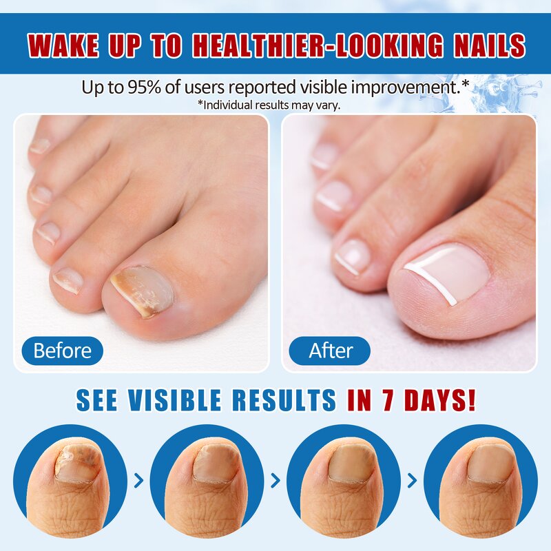 Nail Remover Gel - YECUCE Drop Shipping Customized Soak off Nail Art Cleaner