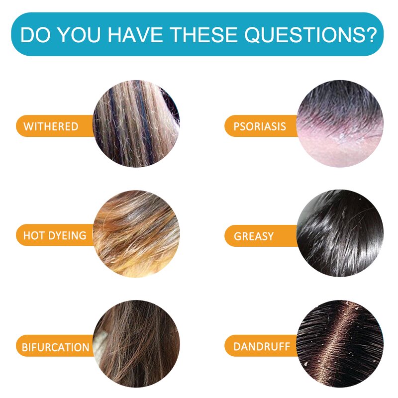 Blackhead Remover - Purifying Peel-off Film Men Skin Care Cleansing