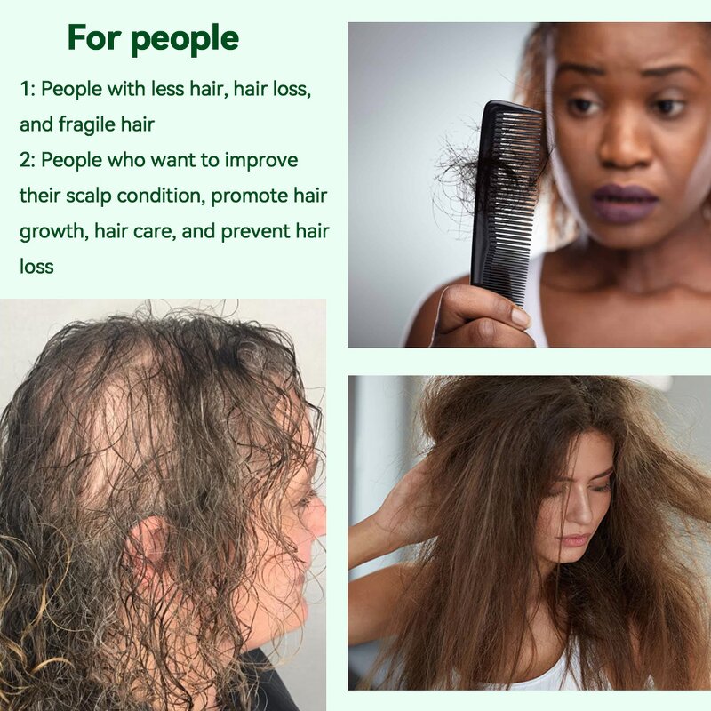 Ginger Oil Manufacturer - Organic for Hair Growth & Anti-Dandruff