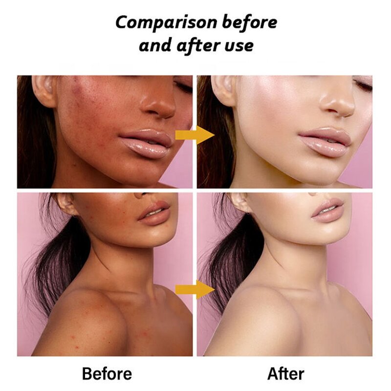 Multi Collagen Capsules Manufacturer - with Biotin Peptides Types I, II, III, V, X