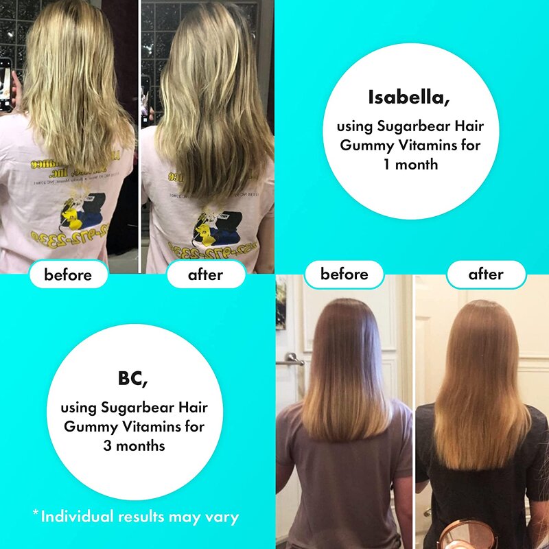 Hair Growth Gummies Manufacturer - Private Label Blue Bear Adult Multivitamin