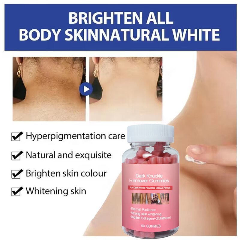 Dark Knuckle Whitening Gummies Manufacturer - OEM Custom with Biotin Collagen