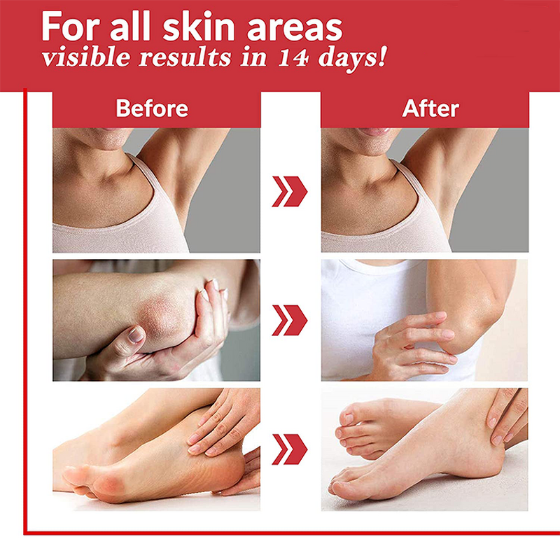 Glutathione Capsule Manufacturer - Hot Product for Skin Whitening & Lightening