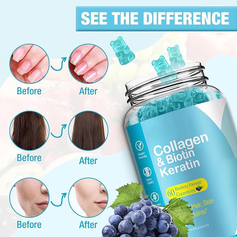 Collagen Gummies - Manufacturer - OEM Private Label Skin Hair Nails Anti-Aging