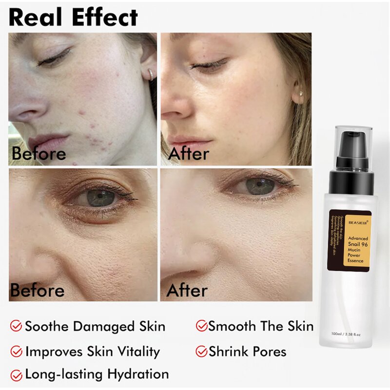 Snail Mucus Face Serum Manufacturer - OEM Wholesale Korean Anti Aging 96% for Sensitive Skin