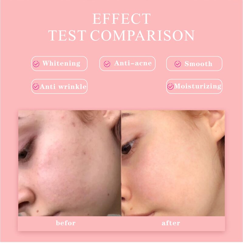 Cosmetic Serum Manufacturer - ShangMei Moisturizing Anti-aging Brightening 5-in-1