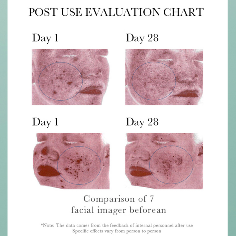 Salicylic Acid Exfoliant Manufacturer - 2% BHA Liquid for Blackheads, Pores & Wrinkles