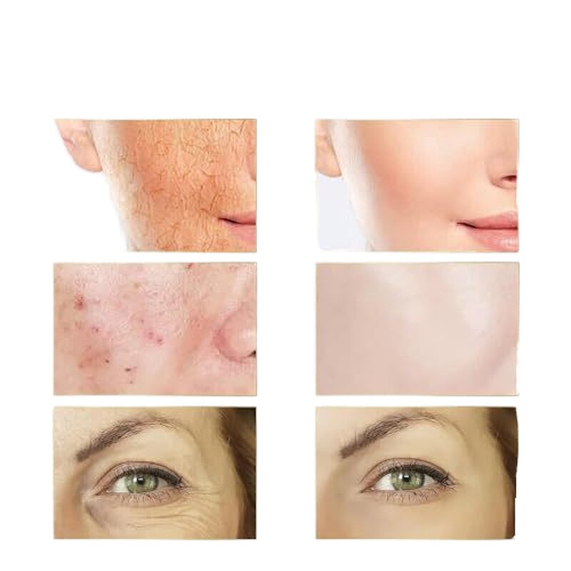 Snail Mucus Face Serum Manufacturer - OEM Wholesale Korean Skincare 96% for Sensitive Skin