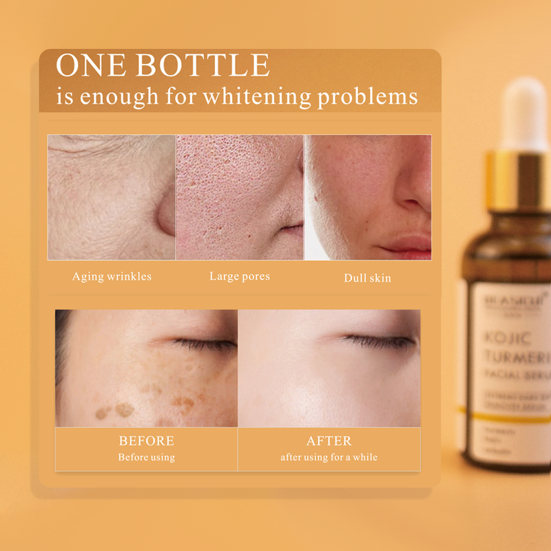 Face Serum Manufacturer - Wholesale with Kojic Acid & Turmeric for Dark Spots