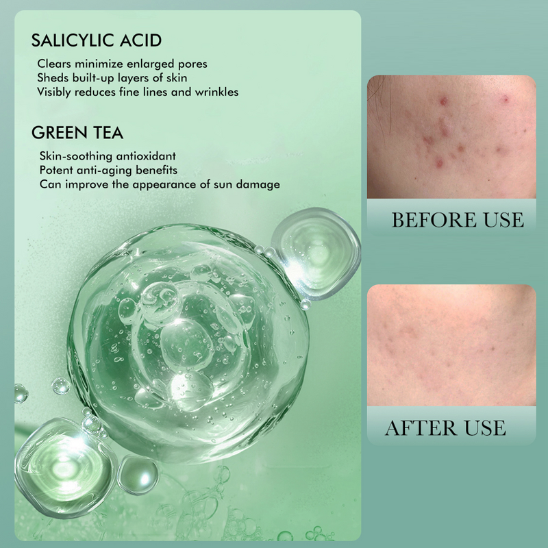 Salicylic Acid Exfoliant Manufacturer - 2% BHA Liquid for Blackheads, Pores & Wrinkles