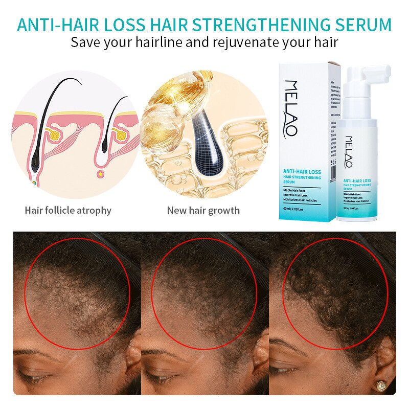 Hair Growth Serum Manufacturer - Fast Repair Scalp Care Anti Hair Loss Treatment