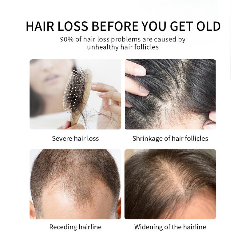 Hair Growth Serum Manufacturer - Fast Repair Scalp Care Anti Hair Loss Treatment