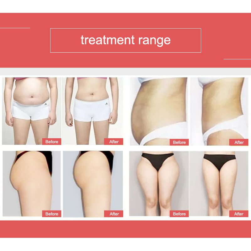 Body Slimming Machine Manufacturer - A Professional 9D Rotation Vacuum Suction Cup Roller