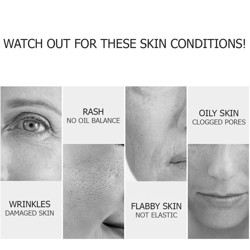 Gold Peptide Kit Manufacturer - GPT Face Absorbable Collagen Protein Thread Lift