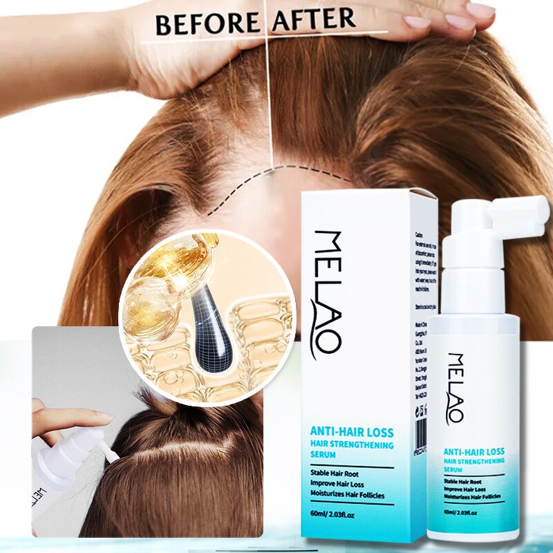 Hair Growth Serum Manufacturer - Fast Repair Scalp Care Anti Hair Loss Treatment