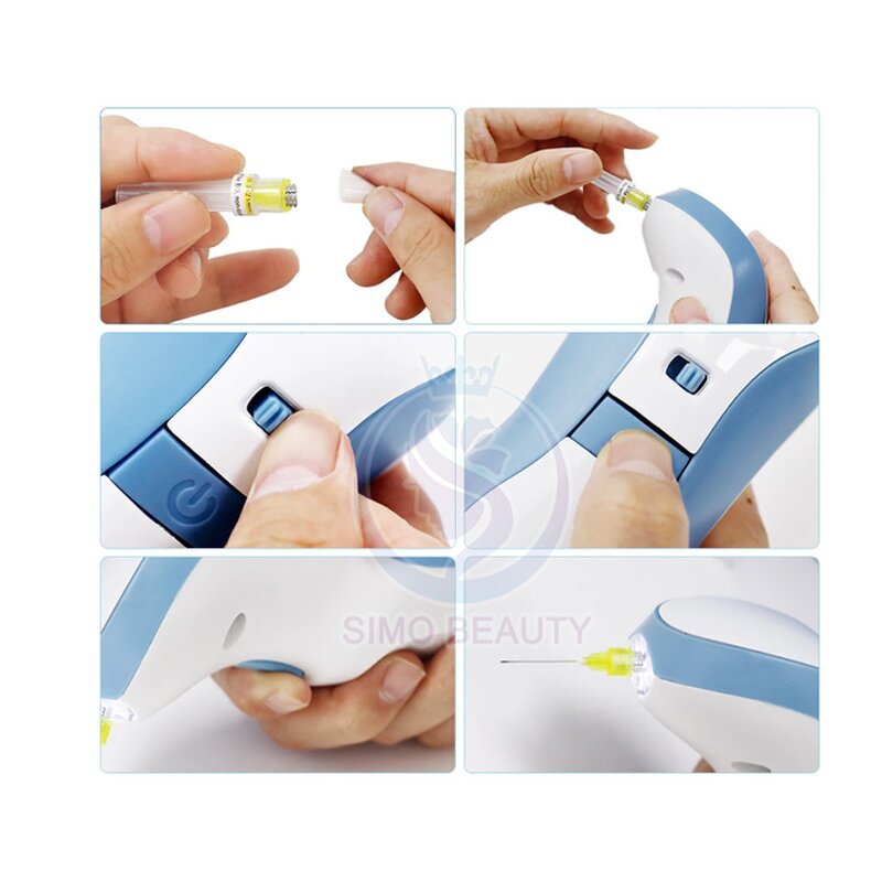 Plasma Pen - Manufacturer - Eyebrow Embroidery Tattoo Removal Korea Large Area