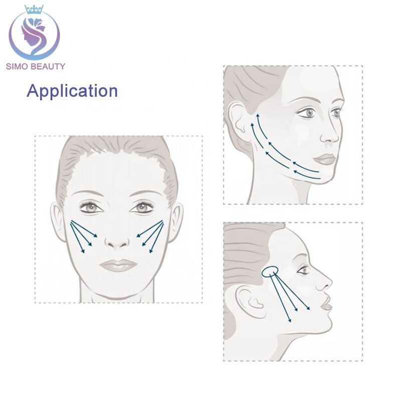 Nasal Thread - Manufacturer - Hump Correction Cone-Cut Alar Russian Princess Nose