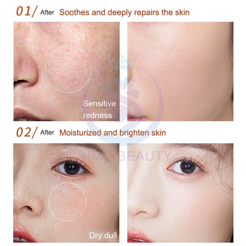 Under Eye Collagen Serum - Manufacturer - Hair Ampoule Peptides Hyaluronic Acid