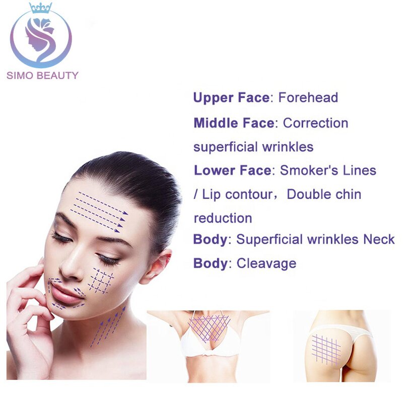 Nasal Thread - Manufacturer - Acne-Prone Ethnic Sculpting OEM/ODM Hump Camouflage