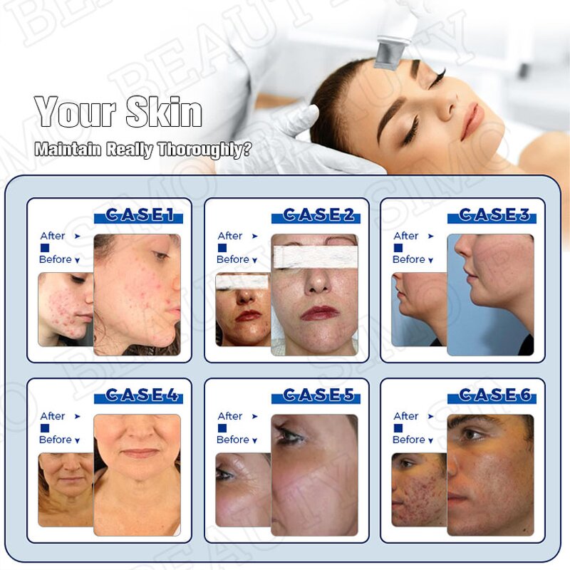 Facial Cooling Gel - Manufacturer - 300g Transparent Royal for RF IPL HIFU Laser