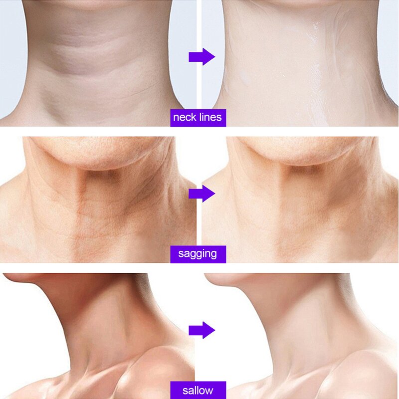 Retinol Booster Serum - Manufacturer - Face Body Uneven Tone Fine Lines Sensitive Skin