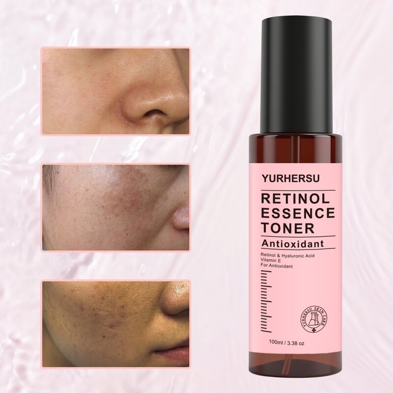 Toning Lotion - Manufacturer - Private Label Purifying Gentle Oily Sensitive Skin