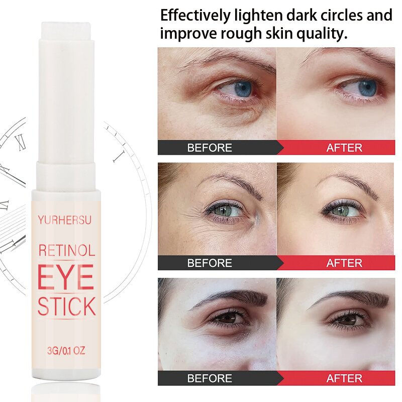 Snail Eye Cream - Manufacturer - Anti-Wrinkle Dark Circles Eye Bags Under Eye Serum