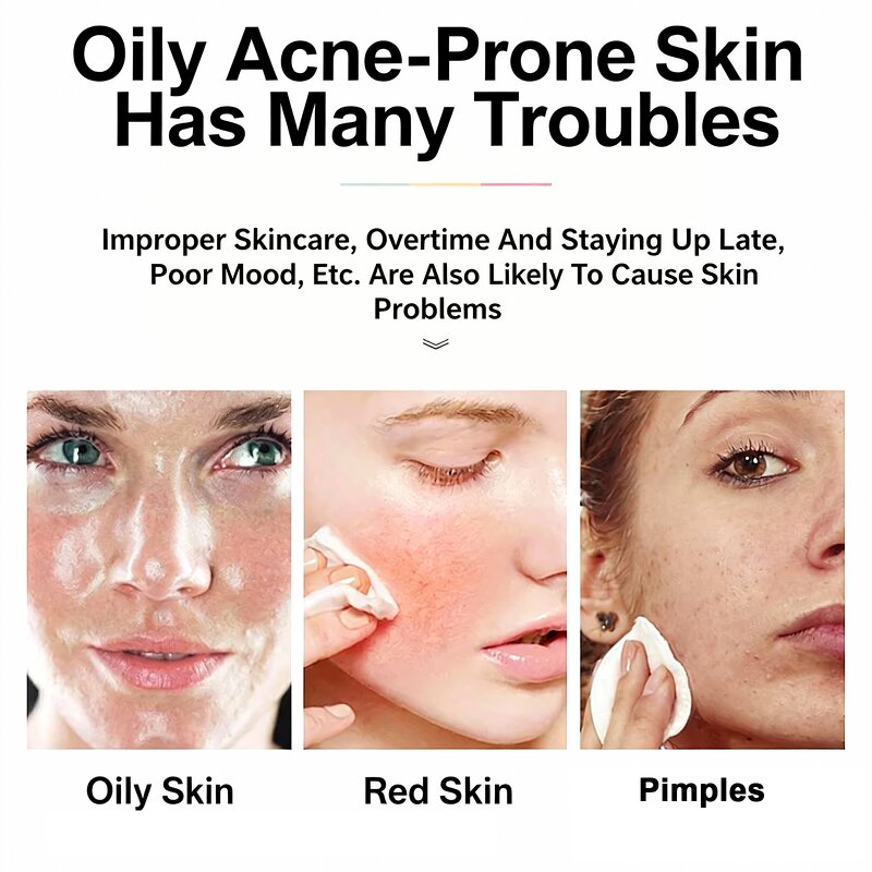 Succinic Acid Pads - Manufacturer - Wholesale Pro Tri Acid Gentle Exfoliation Purify