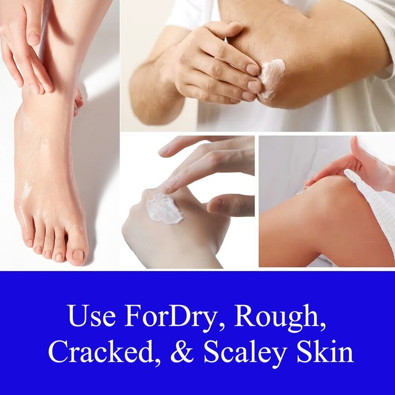 Urea Foot Cream - Manufacturer - OEM 40% Urea Dry Cracked Skin Calluses Feet Care