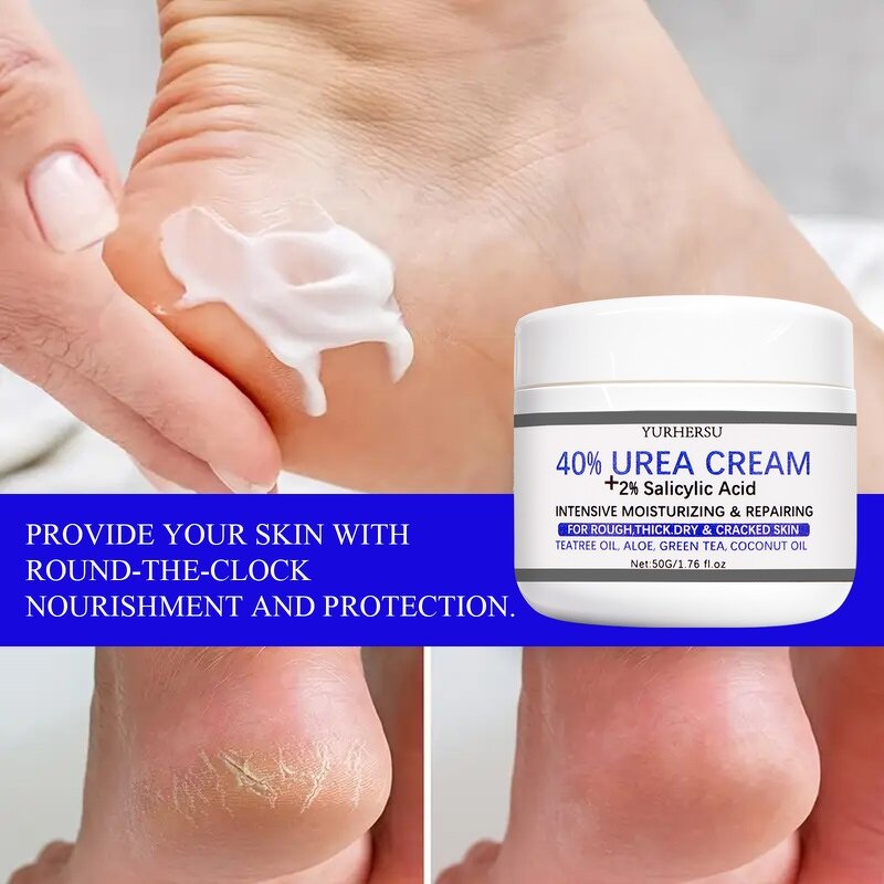 Urea Foot Cream - Manufacturer - OEM 40% Urea Dry Cracked Skin Calluses Feet Care