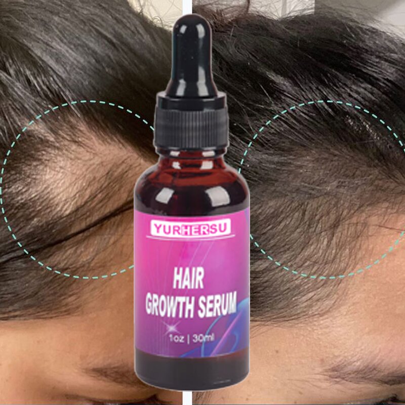 Scalp Treatment Oil - Manufacturer - Private Label Organic Anti Loss Hair Growth Stabilization