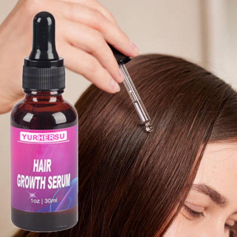 Scalp Treatment Oil - Manufacturer - Private Label Organic Anti Loss Hair Growth Stabilization