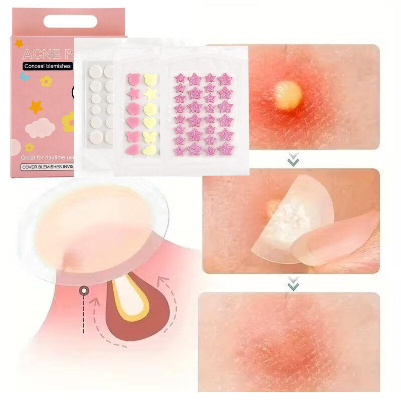 Acne Patch - Manufacturer - Wholesale Salicylic Acid Tea Tree Breathable Invisible Waterproof
