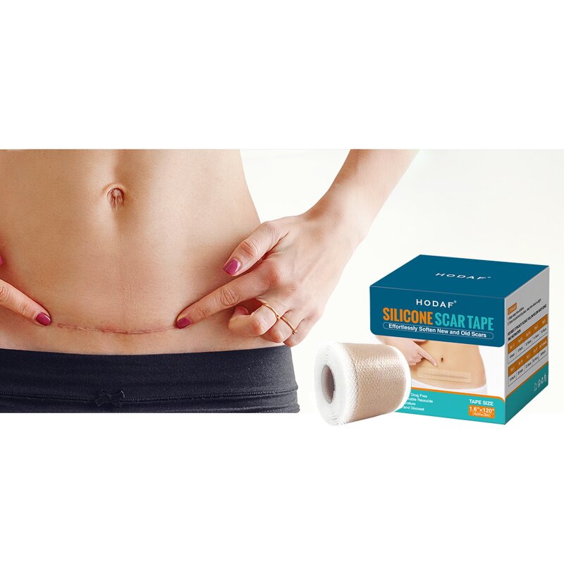 Silicone Scar Patch - Manufacturer - Women Soothing Surgical Keloid C-Section Burn