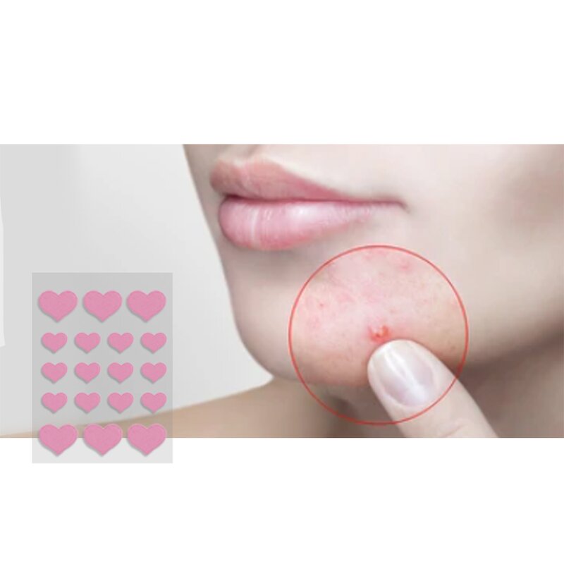 Acne Patches - Manufacturer - Ultra-Thin Hydrocolloid Disposable Spot Stickers