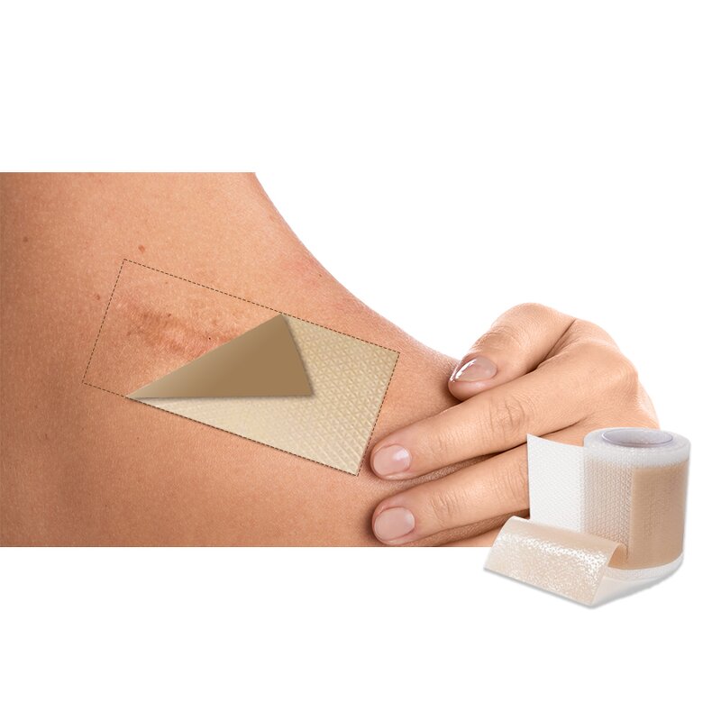 Silicone Scar Strips - Manufacturer - Reusable Self-Adhesive C-Section Scar Tape