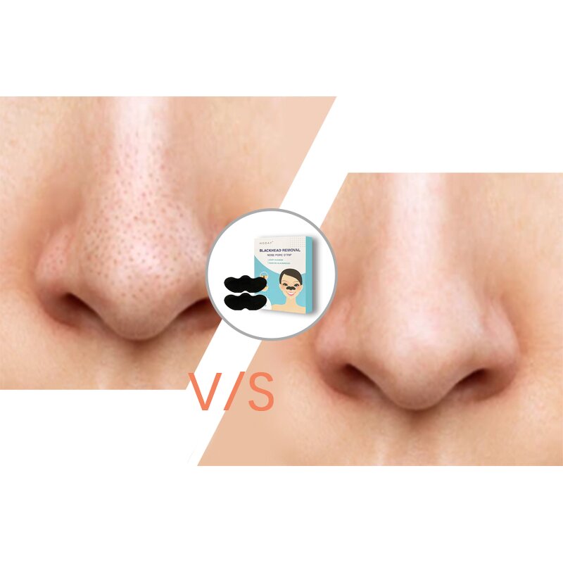 Nose Patches - Manufacturer - Hydrocolloid Pimple Pore Absorbs Oil Overnight