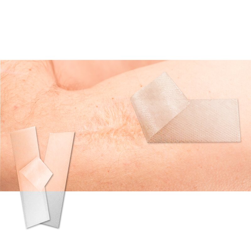 Silicone Scar Strips - Manufacturer - Reusable Self-Adhesive C-Section Scar Tape