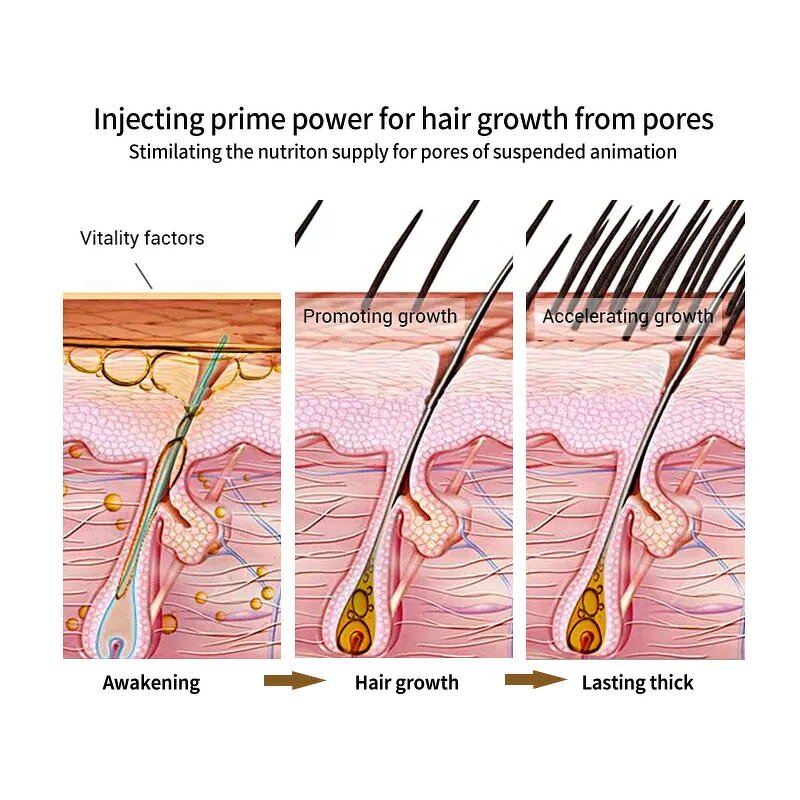 Hair Growth Oil - Manufacturer - China Organic Anti-Dandruff Refreshing Hair Loss Repair