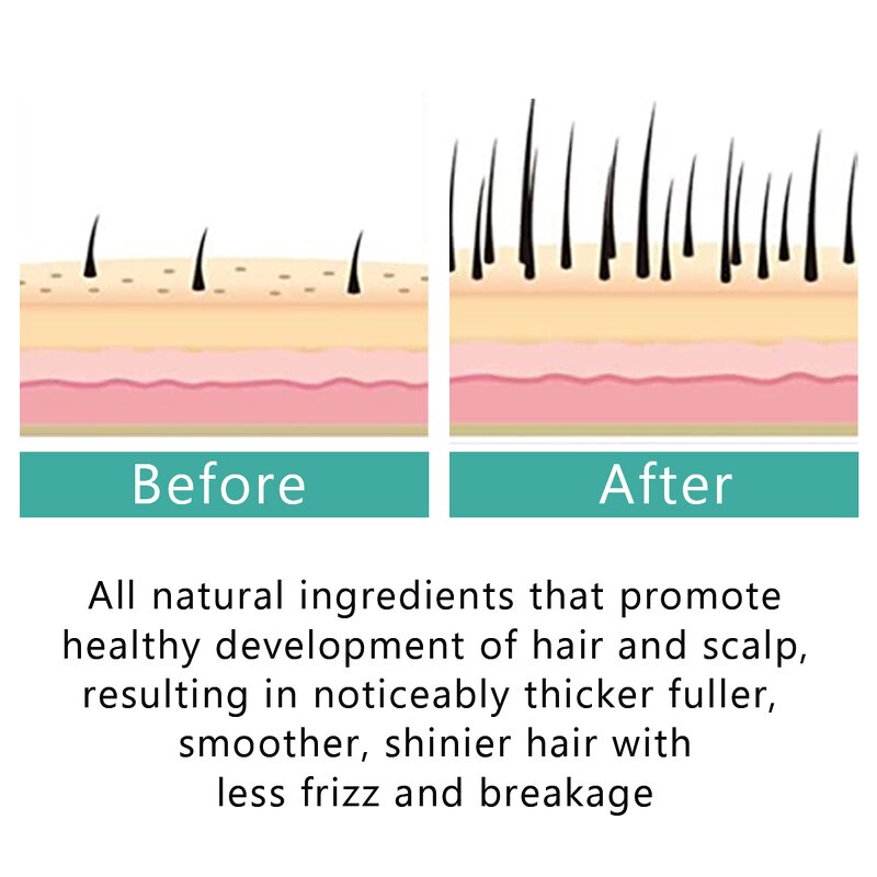 Hair Regrowth Serum - Manufacturer - Private Label Restoration Baldness Thinning Hair Fall Repair