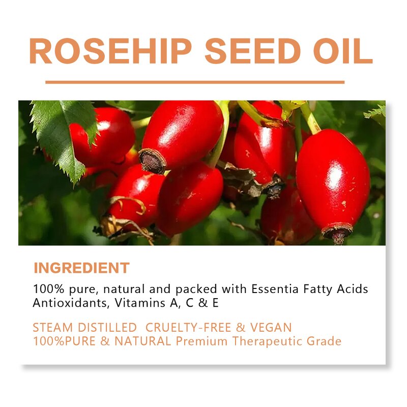 Rosehip Seed Skin Oil - Manufacturer - Stretch Mark Repair Antioxidant Anti-Aging Vitamin E