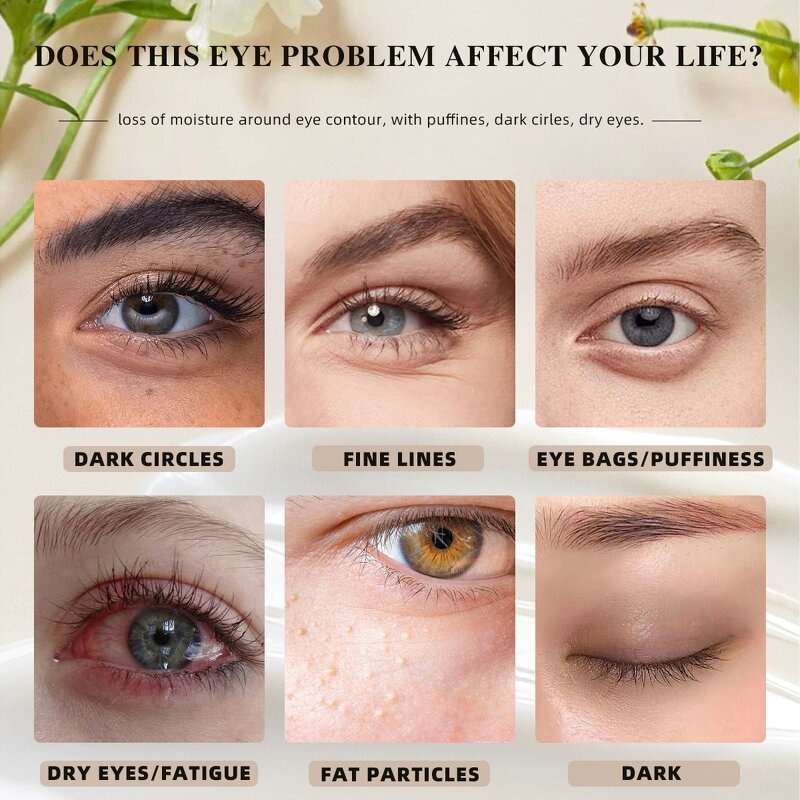 5 in 1 Eye Cream - Manufacturer - Private Label Brightening Eye Bag Remover Firming Lifting Anti Wrinkle