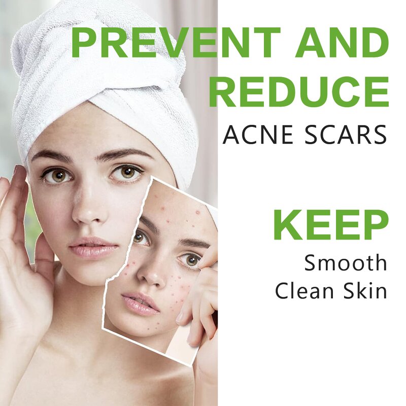 Tea Tree Lavender Oil - Manufacturer - Natural Multi-Use Nourishing Anti Pimple Acne Moisturizer