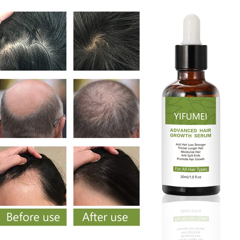Scalp Care Hair Serum - Manufacturer - Private Label Best Repair Moisturized Anti Hair Loss Growth