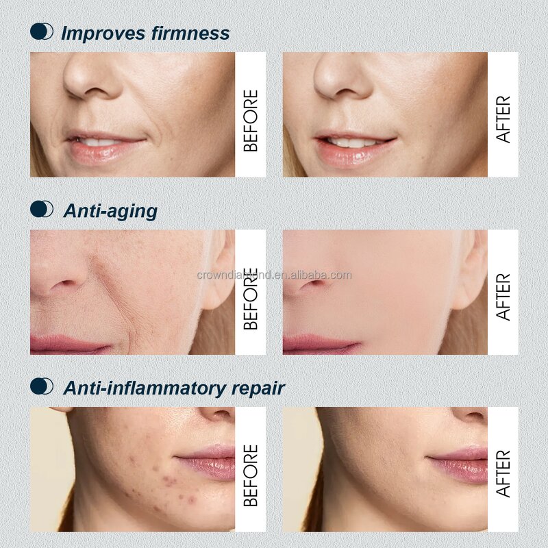 Collagen Face Cream - Manufacturer - Private Label Firming Whitening Anti-Aging GHK-Cu Peptide