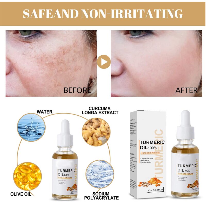 Turmeric Face Oil - Manufacturer - Natural Moisture Dark Spot Corrector Anti Acne Whitening