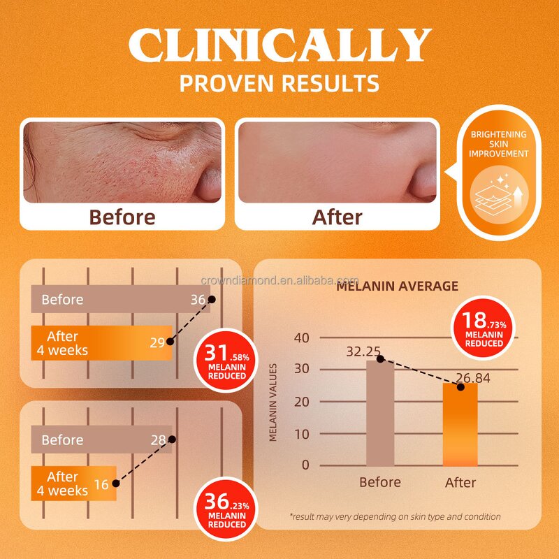 Turmeric Kojic Acid Soap - Manufacturer - OEM Customized Vitamin C Ginger Skin Whitening Glow