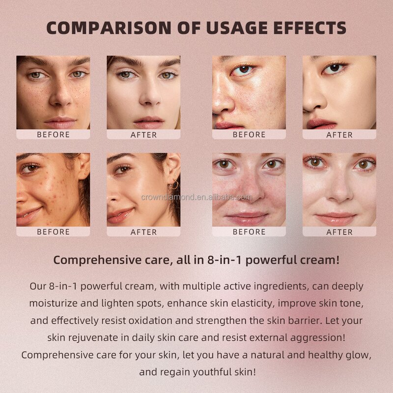 Face Cream - Manufacturer - 8 in 1 Natural Moisturizing Dark Spot Remover Anti Aging Whitening
